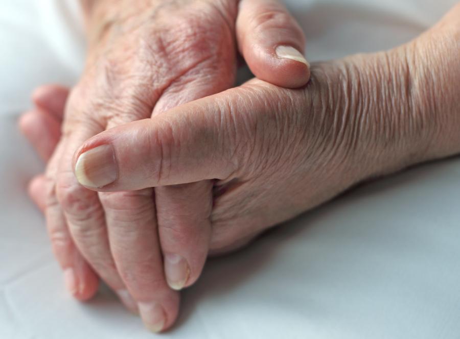 Mit nr 3. Choroba Alzheimera prowadzi do śmierci